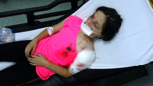 Samsun'da pitbull dehşeti! 11 yaşındaki kız ölümden döndü